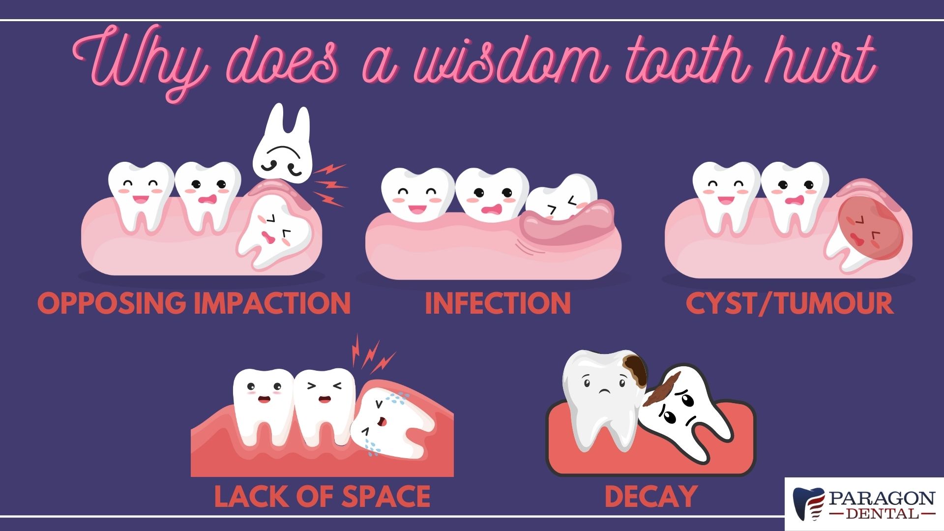 Wisdom Tooth Pain: Causes, Symptoms, and Solutions - Paragon Dental